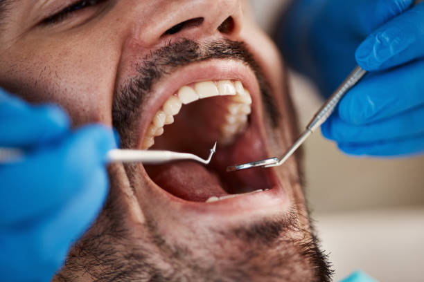 Best After-Hours Emergency Dentist in Wapakoneta, OH