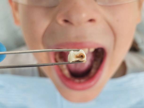 Best Emergency Dental Care for Trauma or Injury in Wapakoneta, OH